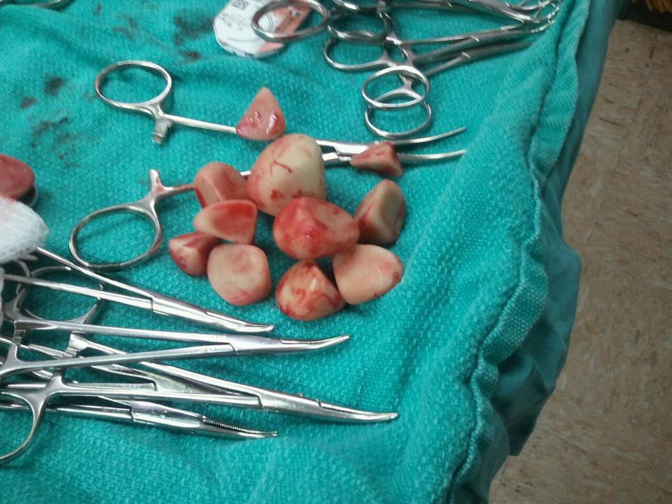 Stones removed from the dogs bladder!